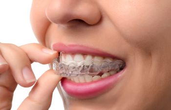 A person is inserting a clear dental aligner onto their teeth.