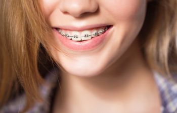A person with light brown hair smiles, showing metal braces on their teeth.
