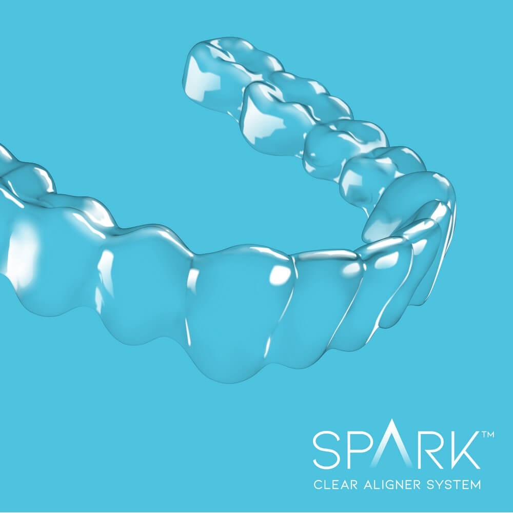 Spark Clear Aligner System - teeth alignment device