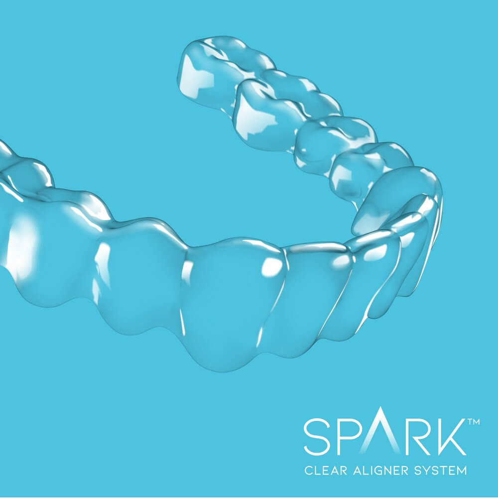 Clear aligner on a blue background with the text "SPARK Clear Aligner System.