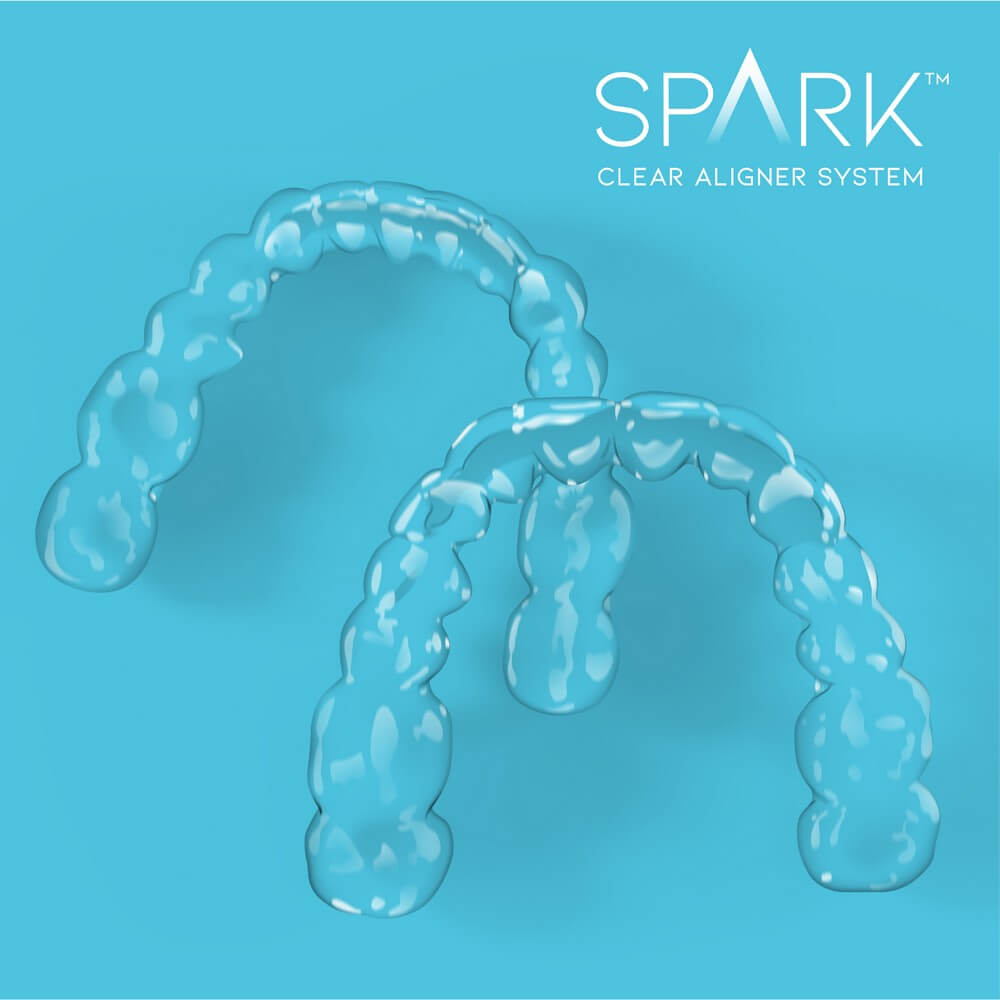 Two clear dental aligners are displayed on a blue background with the text "SPARK Clear Aligner System" in the top right corner.